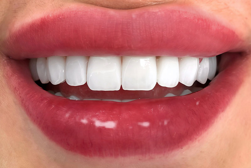 before and after procedure images